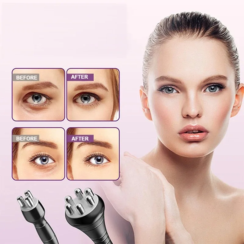2026 Cavitation 80K RF Body Slimming Ultrasonic Machine Radio Frequency SKin Tightening Weight Loss Products That Actually Work - Image 3