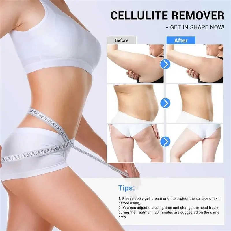2026 Cavitation 80K RF Body Slimming Ultrasonic Machine Radio Frequency SKin Tightening Weight Loss Products That Actually Work - Image 2
