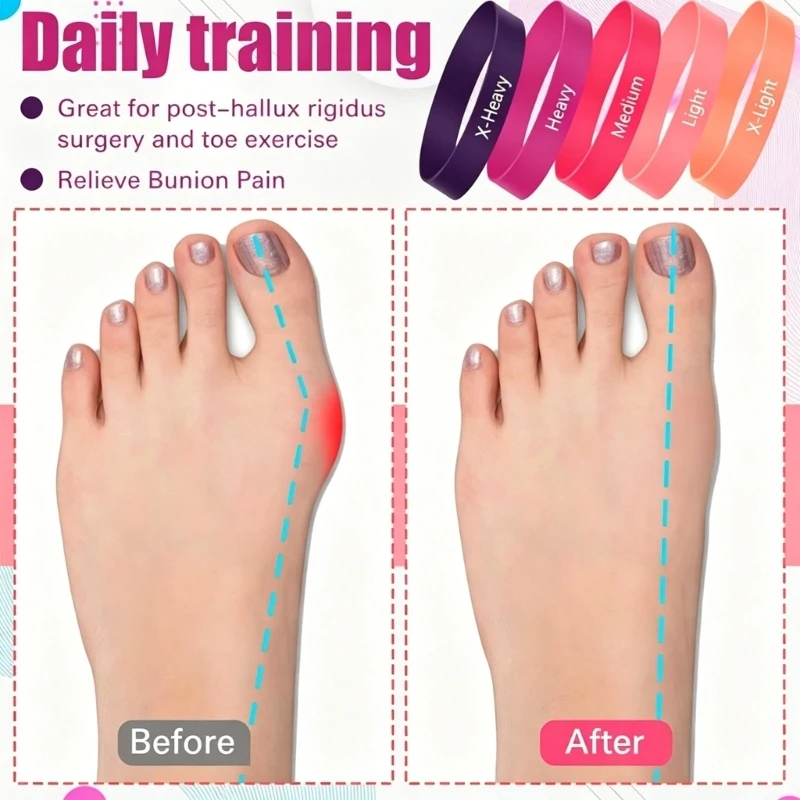 Foot Stretch Set of 5 Elastic Resistance Band for Daily Toe Exercise Travel Practice and Home Stretching Routine 4XBB - Image 4